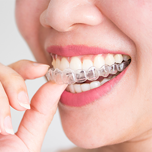 Clear Aligner Therapy – Empower Dental